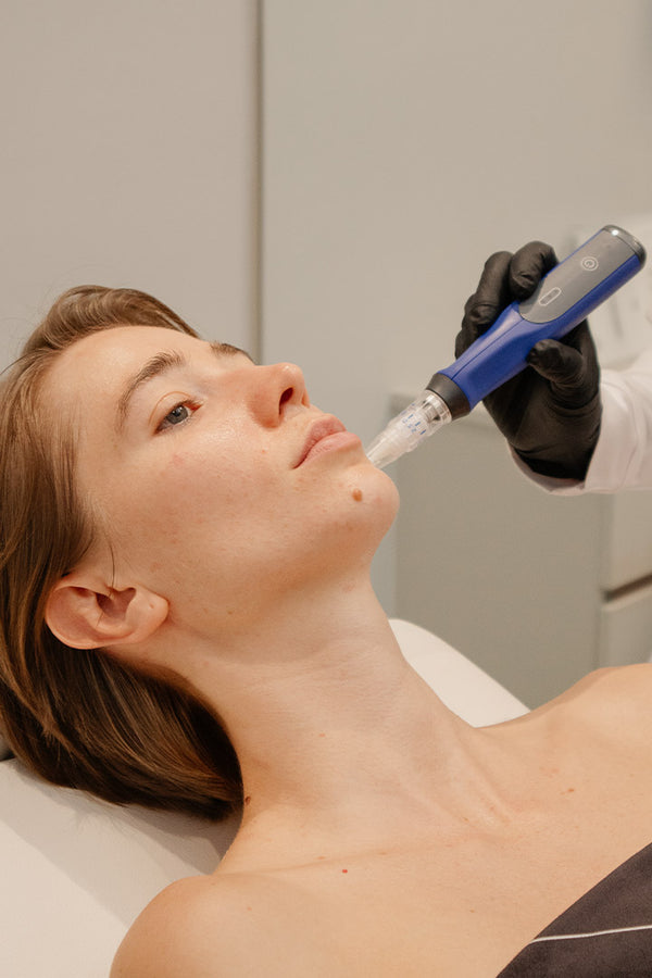 SkinPen